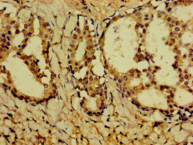 CSB-PA872429ESR1HU IHC-1