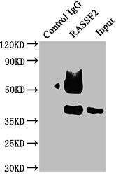 Immunoprecipitating RASSF2 in Raji whole cell lysate Lane 1: Rabbit control IgG instead of CSB-PA019374LA01HU in Raji whole cell lysate. For western blotting, a HRP-conjugated Protein G antibody was used as the secondary antibody (1/50000) Lane 2: CSB-PA019374LA01HU (5?g) + Raji whole cell lysate (0.5mg) Lane 3: Raji whole cell lysate (20?g)