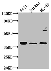 Western Blot Positive WB detected in: Raji whole cell lysate, Jurkat whole cell lysate, HL-60 whole cell lysate All lanes: RASSF2 antibody at 1:2000 Secondary Goat polyclonal to rabbit IgG at 1/50000 dilution Predicted band size: 38, 18 kDa Observed band size: 38 kDa Western Blot Positive WB detected in: Raji whole cell lysate, Jurkat whole cell lysate, HL-60 whole cell lysate All lanes: RASSF2 antibody at 1:2000 Secondary Goat polyclonal to rabbit IgG at 1/50000 dilution Predicted band size: 38, 18 kDa Observed band size: 38 kDa