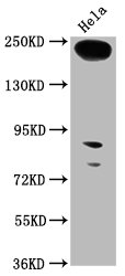 Western Blot Positive WB detected in: Hela whole cell lysate All lanes: RTTN antibody at 1:1000 Secondary Goat polyclonal to rabbit IgG at 1/50000 dilution Predicted band size: 249, 68, 246, 99 kDa Observed band size: 249 kDa