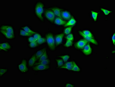 Immunofluorescence staining of HepG2 cells with CSB-PA020731LA01HU at 1:100, counter-stained with DAPI. The cells were fixed in 4% formaldehyde, permeabilized using 0.2% Triton X-100 and blocked in 10% normal Goat Serum. The cells were then incubated with the antibody overnight at 4°C. The secondary antibody was Alexa Fluor 488-congugated AffiniPure Goat Anti-Rabbit IgG(H+L).