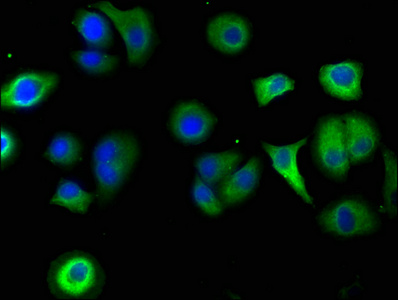 Immunofluorescence staining of A549 cells with CSB-PA020731LA01HU at 1:50, counter-stained with DAPI. The cells were fixed in 4% formaldehyde, permeabilized using 0.2% Triton X-100 and blocked in 10% normal Goat Serum. The cells were then incubated with the antibody overnight at 4°C. The secondary antibody was Alexa Fluor 488-congugated AffiniPure Goat Anti-Rabbit IgG(H+L).