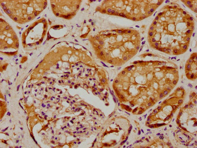 IHC image of CSB-PA020731LA01HU diluted at 1:100 and staining in paraffin-embedded human kidney tissue performed on a Leica BondTM system. After dewaxing and hydration, antigen retrieval was mediated by high pressure in a citrate buffer (pH 6.0). Section was blocked with 10% normal goat serum 30min at RT. Then primary antibody (1% BSA) was incubated at 4°C overnight. The primary is detected by a biotinylated secondary antibody and visualized using an HRP conjugated SP system.