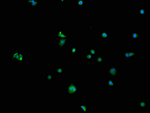 Immunofluorescence staining of MCF-7 cells with CSB-PA020992LA01HU at 1:100, counter-stained with DAPI. The cells were blocked in 10% normal Goat Serum and incubated with the antibody overnight at 4°C. The secondary antibody was Alexa Fluor 488-congugated AffiniPure Goat Anti-Rabbit IgG(H+L). Immunofluorescence staining of MCF-7 cells with CSB-PA020992LA01HU at 1:100, counter-stained with DAPI. The cells were blocked in 10% normal Goat Serum and incubated with the antibody overnight at 4°C. The secondary antibody was Alexa Fluor 488-congugated AffiniPure Goat Anti-Rabbit IgG(H+L).