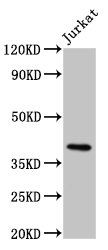 Western Blotting(WB) 2- HLA-G Antibody