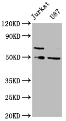 Western Blot Positive WB detected in: Jurkat whole cell lysate, U87 whole cell lysate All lanes: SH3BP5 antibody at 1:2000 Secondary Goat polyclonal to rabbit IgG at 1/50000 dilution Predicted band size: 51, 33 kDa Observed band size: 51 kDa