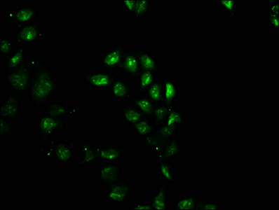 Immunofluorescence staining of Hela cells with CSB-PA021329LA01HU at 1:100, counter-stained with DAPI. The cells were fixed in 4% formaldehyde, permeabilized using 0.2% Triton X-100 and blocked in 10% normal Goat Serum. The cells were then incubated with the antibody overnight at 4°C. The secondary antibody was Alexa Fluor 488-congugated AffiniPure Goat Anti-Rabbit IgG(H+L).