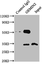 Immunoprecipitating GEMIN2 in 293T whole cell lysate Lane 1: Rabbit control IgG instead of CSB-PA021329LA01HU in 293T whole cell lysate. For western blotting, a HRP-conjugated Protein G antibody was used as the secondary antibody (1/50000) Lane 2: CSB-PA021329LA01HU (6microg) + 293T whole cell lysate (0.5mg) Lane 3: 293T whole cell lysate (20microg)