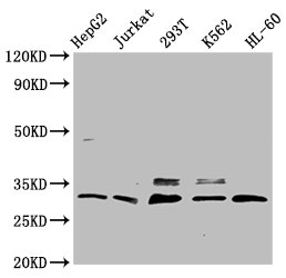 Western Blot Positive WB detected in: HepG2 whole cell lysate, Jurkat whole cell lysate, 293T whole cell lysate, K562 whole cell lysate, HL-60 whole cell lysate All lanes: GEMIN2 antibody at 3.7microg/ml Secondary Goat polyclonal to rabbit IgG at 1/50000 dilution Predicted band size: 32, 30, 29, 5 kDa Observed band size: 32 kDa Western Blot Positive WB detected in: HepG2 whole cell lysate, Jurkat whole cell lysate, 293T whole cell lysate, K562 whole cell lysate, HL-60 whole cell lysate All lanes: GEMIN2 antibody at 3.7microg/ml Secondary Goat polyclonal to rabbit IgG at 1/50000 dilution Predicted band size: 32, 30, 29, 5 kDa Observed band size: 32 kDa