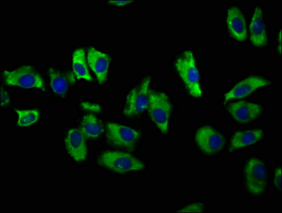 Immunofluorescence staining of A549 cells with CSB-PA021383LA01HU at 1:100, counter-stained with DAPI. The cells were fixed in 4% formaldehyde, permeabilized using 0.2% Triton X-100 and blocked in 10% normal Goat Serum. The cells were then incubated with the antibody overnight at 4°C. The secondary antibody was Alexa Fluor 488-congugated AffiniPure Goat Anti-Rabbit IgG(H+L).