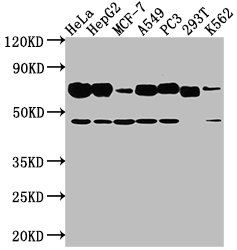 Western Blot Positive WB detected in: Hela whole cell lysate, HepG2 whole cell lysate, MCF-7 whole cell lysate, A549 whole cell lysate, PC3 whole cell lysate, 293T whole cell lysate, K562 whole cell lysate All lanes: SLC3A2 antibody at 1:2000 Secondary Goat polyclonal to rabbit IgG at 1/50000 dilution Predicted band size: 68, 58, 62, 72 kDa Observed band size: 68 kDa Western Blot Positive WB detected in: Hela whole cell lysate, HepG2 whole cell lysate, MCF-7 whole cell lysate, A549 whole cell lysate, PC3 whole cell lysate, 293T whole cell lysate, K562 whole cell lysate All lanes: SLC3A2 antibody at 1:2000 Secondary Goat polyclonal to rabbit IgG at 1/50000 dilution Predicted band size: 68, 58, 62, 72 kDa Observed band size: 68 kDa