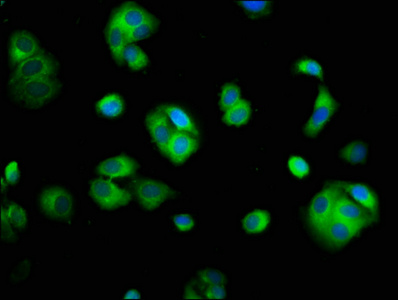 Immunofluorescence staining of HepG2 cells with CSB-PA021814LA01HU at 1:100, counter-stained with DAPI. The cells were fixed in 4% formaldehyde, permeabilized using 0.2% Triton X-100 and blocked in 10% normal Goat Serum. The cells were then incubated with the antibody overnight at 4°C. The secondary antibody was Alexa Fluor 488-congugated AffiniPure Goat Anti-Rabbit IgG(H+L). Immunofluorescence staining of HepG2 cells with CSB-PA021814LA01HU at 1:100, counter-stained with DAPI. The cells were fixed in 4% formaldehyde, permeabilized using 0.2% Triton X-100 and blocked in 10% normal Goat Serum. The cells were then incubated with the antibody overnight at 4°C. The secondary antibody was Alexa Fluor 488-congugated AffiniPure Goat Anti-Rabbit IgG(H+L).