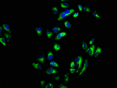 Immunofluorescence staining of Hela cells with CSB-PA021871LA01HU at 1:66, counter-stained with DAPI. The cells were fixed in 4% formaldehyde, permeabilized using 0.2% Triton X-100 and blocked in 10% normal Goat Serum. The cells were then incubated with the antibody overnight at 4°C. The secondary antibody was Alexa Fluor 488-congugated AffiniPure Goat Anti-Rabbit IgG(H+L).