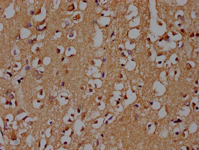 IHC image of CSB-PA021912OA01HU diluted at 1:100 and staining in paraffin-embedded human brain tissue performed on a Leica BondTM system. After dewaxing and hydration, antigen retrieval was mediated by high pressure in a citrate buffer (pH 6.0). Section was blocked with 10% normal goat serum 30min at RT. Then primary antibody (1% BSA) was incubated at 4°C overnight. The primary is detected by a biotinylated secondary antibody and visualized using an HRP conjugated SP system. IHC image of CSB-PA021912OA01HU diluted at 1:100 and staining in paraffin-embedded human brain tissue performed on a Leica BondTM system. After dewaxing and hydration, antigen retrieval was mediated by high pressure in a citrate buffer (pH 6.0). Section was blocked with 10% normal goat serum 30min at RT. Then primary antibody (1% BSA) was incubated at 4°C overnight. The primary is detected by a biotinylated secondary antibody and visualized using an HRP conjugated SP system.