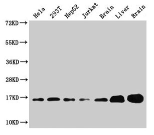 Western Blot Positive WB detected in: Hela whole cell lysate, 293T whole cell lysate, HepG2 whole cell lysate, Jurkat whole cell lysate, Rat brain tissue, Rat liver tissue, Mouse brain tissue All lanes: Sod1 antibody at 3microg/ml Secondary Goat polyclonal to rabbit IgG at 1/50000 dilution Predicted band size: 16 kDa Observed band size: 16 kDa