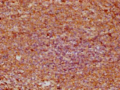IHC image of CSB-PA022664EA01HU diluted at 1:400 and staining in paraffin-embedded human spleen tissue performed on a Leica BondTM system. After dewaxing and hydration, antigen retrieval was mediated by high pressure in a citrate buffer (pH 6.0). Section was blocked with 10% normal goat serum 30min at RT. Then primary antibody (1% BSA) was incubated at 4°C overnight. The primary is detected by a biotinylated secondary antibody and visualized using an HRP conjugated SP system. IHC image of CSB-PA022664EA01HU diluted at 1:400 and staining in paraffin-embedded human spleen tissue performed on a Leica BondTM system. After dewaxing and hydration, antigen retrieval was mediated by high pressure in a citrate buffer (pH 6.0). Section was blocked with 10% normal goat serum 30min at RT. Then primary antibody (1% BSA) was incubated at 4°C overnight. The primary is detected by a biotinylated secondary antibody and visualized using an HRP conjugated SP system.