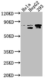 Western Blot Positive WB detected in: Hela whole cell lysate, HepG2 whole cell lysate, 293 whole cell lysate All lanes: SRPK2 antibody at 1:1000 Secondary Goat polyclonal to rabbit IgG at 1/50000 dilution Predicted band size: 78, 80 kDa Observed band size: 78 kDa