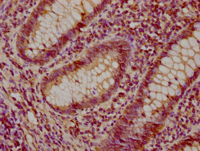 IHC image of CSB-PA022934LA01HU diluted at 1:200 and staining in paraffin-embedded human appendix tissue performed on a Leica BondTM system. After dewaxing and hydration, antigen retrieval was mediated by high pressure in a citrate buffer (pH 6.0). Section was blocked with 10% normal goat serum 30min at RT. Then primary antibody (1% BSA) was incubated at 4°C overnight. The primary is detected by a biotinylated secondary antibody and visualized using an HRP conjugated SP system.