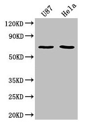 Western Blotting(WB) - SUSD5 Antibody