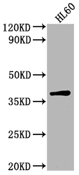 Western Blot Positive WB detected in: HL60 whole cell lysate All lanes: TCF19 antibody at 1:2000 Secondary Goat polyclonal to rabbit IgG at 1/50000 dilution Predicted band size: 38 kDa Observed band size: 38 kDa Western Blot Positive WB detected in: HL60 whole cell lysate All lanes: TCF19 antibody at 1:2000 Secondary Goat polyclonal to rabbit IgG at 1/50000 dilution Predicted band size: 38 kDa Observed band size: 38 kDa
