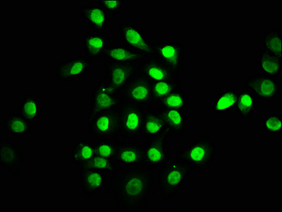 Immunofluorescence staining of A549 cells with CSB-PA023363DSR2HU at 1:147, counter-stained with DAPI. The cells were fixed in 4% formaldehyde, permeabilized using 0.2% Triton X-100 and blocked in 10% normal Goat Serum. The cells were then incubated with the antibody overnight at 4°C. The secondary antibody was Alexa Fluor 488-congugated AffiniPure Goat Anti-Rabbit IgG(H+L).