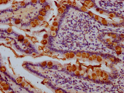 IHC image of CSB-PA023433LA01HU diluted at 1:1000 and staining in paraffin-embedded human small intestine tissue performed on a Leica BondTM system. After dewaxing and hydration, antigen retrieval was mediated by high pressure in a citrate buffer (pH 6.0). Section was blocked with 10% normal goat serum 30min at RT. Then primary antibody (1% BSA) was incubated at 4°C overnight. The primary is detected by a Goat anti-rabbit IgG polymer labeled by HRP and visualized using 0.05% DAB.