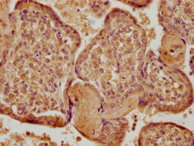 IHC image of CSB-PA023438LA01HU diluted at 1:400 and staining in paraffin-embedded human placenta tissue performed on a Leica BondTM system. After dewaxing and hydration, antigen retrieval was mediated by high pressure in a citrate buffer (pH 6.0). Section was blocked with 10% normal goat serum 30min at RT. Then primary antibody (1% BSA) was incubated at 4°C overnight. The primary is detected by a biotinylated secondary antibody and visualized using an HRP conjugated SP system. IHC image of CSB-PA023438LA01HU diluted at 1:400 and staining in paraffin-embedded human placenta tissue performed on a Leica BondTM system. After dewaxing and hydration, antigen retrieval was mediated by high pressure in a citrate buffer (pH 6.0). Section was blocked with 10% normal goat serum 30min at RT. Then primary antibody (1% BSA) was incubated at 4°C overnight. The primary is detected by a biotinylated secondary antibody and visualized using an HRP conjugated SP system.