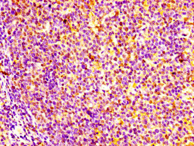 Immunohistochemistry of paraffin-embedded human tonsil tissue using CSB-PA02379A0Rb at dilution of 1:100