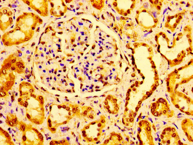 Immunohistochemistry of paraffin-embedded human kidney tissue using CSB-PA02379A0Rb at dilution of 1:100