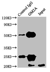 Immunoprecipitating GM2A in HEK293 whole cell lysate Lane 1: Rabbit control IgG instead of CSB-PA02379A0Rb in HEK293 whole cell lysate. For western blotting, a HRP-conjugated Protein G antibody was used as the secondary antibody (1/2000) Lane 2: CSB-PA02379A0Rb (8microg) + HEK293 whole cell lysate (500microg) Lane 3: HEK293 whole cell lysate (10microg)
