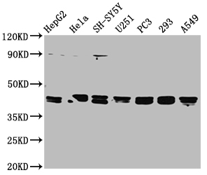 Western Blot Positive WB detected in: HepG2 whole cell lysate, Hela whole cell lysate, SH-SY5Y whole cell lysate, U251 whole cell lysate, PC-3 whole cell lysate, 293 whole cell lysate, A549 whole cell lysate All lanes: TPST1 antibody at 1:2000 Secondary Goat polyclonal to rabbit IgG at 1/50000 dilution Predicted band size: 43 kDa Observed band size: 43 kDa Western Blot Positive WB detected in: HepG2 whole cell lysate, Hela whole cell lysate, SH-SY5Y whole cell lysate, U251 whole cell lysate, PC-3 whole cell lysate, 293 whole cell lysate, A549 whole cell lysate All lanes: TPST1 antibody at 1:2000 Secondary Goat polyclonal to rabbit IgG at 1/50000 dilution Predicted band size: 43 kDa Observed band size: 43 kDa