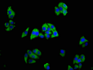 Immunofluorescence(IF) - TREM2 Antibody