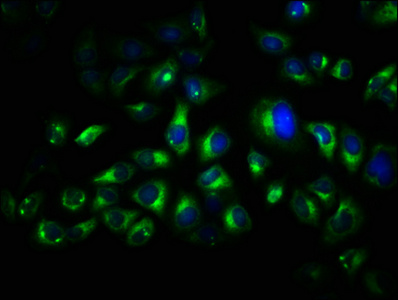 Immunofluorescence staining of Hela cells with CSB-PA025069LA01HU at 1:66, counter-stained with DAPI. The cells were fixed in 4% formaldehyde, permeabilized using 0.2% Triton X-100 and blocked in 10% normal Goat Serum. The cells were then incubated with the antibody overnight at 4°C. The secondary antibody was Alexa Fluor 488-congugated AffiniPure Goat Anti-Rabbit IgG(H+L). Immunofluorescence staining of Hela cells with CSB-PA025069LA01HU at 1:66, counter-stained with DAPI. The cells were fixed in 4% formaldehyde, permeabilized using 0.2% Triton X-100 and blocked in 10% normal Goat Serum. The cells were then incubated with the antibody overnight at 4°C. The secondary antibody was Alexa Fluor 488-congugated AffiniPure Goat Anti-Rabbit IgG(H+L).