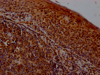 IHC image of CSB-PA02519A0Rb diluted at 1:400 and staining in paraffin-embedded human tonsil tissue performed on a Leica BondTM system. After dewaxing and hydration, antigen retrieval was mediated by high pressure in a citrate buffer (pH 6.0). Section was blocked with 10% normal goat serum 30min at RT. Then primary antibody (1% BSA) was incubated at 4°C overnight. The primary is detected by a Goat anti-rabbit polymer IgG labeled by HRP and visualized using 0.05% DAB. IHC image of CSB-PA02519A0Rb diluted at 1:400 and staining in paraffin-embedded human tonsil tissue performed on a Leica BondTM system. After dewaxing and hydration, antigen retrieval was mediated by high pressure in a citrate buffer (pH 6.0). Section was blocked with 10% normal goat serum 30min at RT. Then primary antibody (1% BSA) was incubated at 4°C overnight. The primary is detected by a Goat anti-rabbit polymer IgG labeled by HRP and visualized using 0.05% DAB.