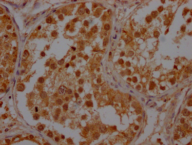 IHC image of CSB-PA02519A0Rb diluted at 1:400 and staining in paraffin-embedded human testis tissue performed on a Leica BondTM system. After dewaxing and hydration, antigen retrieval was mediated by high pressure in a citrate buffer (pH 6.0). Section was blocked with 10% normal goat serum 30min at RT. Then primary antibody (1% BSA) was incubated at 4°C overnight. The primary is detected by a Goat anti-rabbit polymer IgG labeled by HRP and visualized using 0.05% DAB.