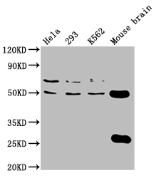 Western Blot Positive WB detected in: Hela whole cell lysate, 293 whole cell lysate, K562 whole cell lysate, Mouse brain tissue All lanes: TUBB4A antibody at 1:2000 Secondary Goat polyclonal to rabbit IgG at 1/50000 dilution Predicted band size: 50 kDa Observed band size: 50 kDa