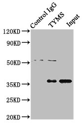 Immunoprecipitating TYMS in Hela whole cell lysate Lane 1: Rabbit control IgG instead of CSB-PA025393LA01HU in Hela whole cell lysate. For western blotting, a HRP-conjugated Protein G antibody was used as the secondary antibody (1/2000) Lane 2: CSB-PA025393LA01HU (8microg) + Hela whole cell lysate (500microg) Lane 3: Hela whole cell lysate (10microg)