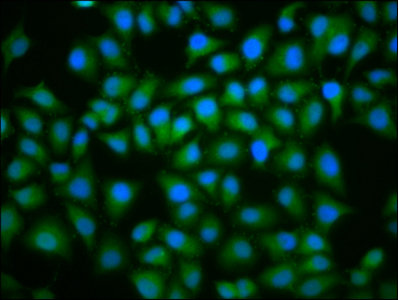 Immunofluorescence staining of Hela cells with CSB-PA025444LA01HU at 1:100, counter-stained with DAPI. The cells were fixed in 4% formaldehyde, permeabilized using 0.2% Triton X-100 and blocked in 10% normal Goat Serum. The cells were then incubated with the antibody overnight at 4°C. The secondary antibody was Alexa Fluor 488-congugated AffiniPure Goat Anti-Rabbit IgG(H+L).