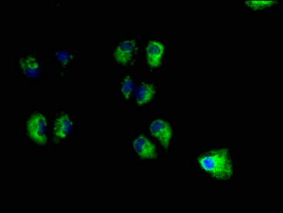 Immunofluorescence staining of Hela cells with CSB-PA025622LA01HU at 1:100, counter-stained with DAPI. The cells were fixed in 4% formaldehyde, permeabilized using 0.2% Triton X-100 and blocked in 10% normal Goat Serum. The cells were then incubated with the antibody overnight at 4°C. The secondary antibody was Alexa Fluor 488-congugated AffiniPure Goat Anti-Rabbit IgG(H+L).