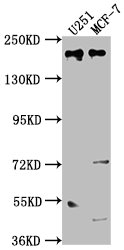 Western Blot Positive WB detected in: U251 whole cell lysate, MCF-7 whole cell lysate All lanes: UNC13B antibody at 1:2000 Secondary Goat polyclonal to rabbit IgG at 1/50000 dilution Predicted band size: 181, 183 kDa Observed band size: 181 kDa