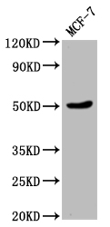 Western Blot Positive WB detected in: MCF-7 whole cell lysate All lanes: VPS4B antibody at 1:2000 Secondary Goat polyclonal to rabbit IgG at 1/50000 dilution Predicted band size: 50 kDa Observed band size: 50 kDa