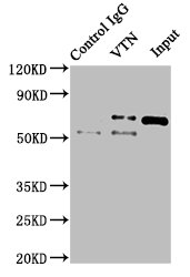 Immunoprecipitating VTN in NIH/3T3 whole cell lysate Lane 1: Rabbit control IgG instead of CSB-PA025944ESR1HU in NIH/3T3 whole cell lysate. For western blotting, a HRP-conjugated Protein G antibody was used as the secondary antibody (1/2000) Lane 2: CSB-PA025944ESR1HU (8ug) + NIH/3T3 whole cell lysate (500ug) Lane 3: NIH/3T3 whole cell lysate (10ug)