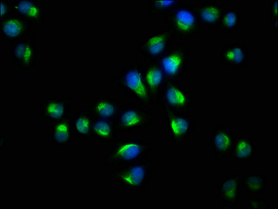 Immunofluorescence staining of Hela cells with CSB-PA026290ESR1HU at 1:73, counter-stained with DAPI. The cells were fixed in 4% formaldehyde, permeabilized using 0.2% Triton X-100 and blocked in 10% normal Goat Serum. The cells were then incubated with the antibody overnight at 4°C. The secondary antibody was Alexa Fluor 488-congugated AffiniPure Goat Anti-Rabbit IgG(H+L).