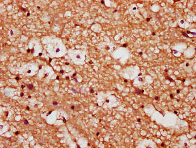 IHC image of CSB-PA026290ESR2HU diluted at 1:173 and staining in paraffin-embedded human brain tissue performed on a Leica BondTM system. After dewaxing and hydration, antigen retrieval was mediated by high pressure in a citrate buffer (pH 6.0). Section was blocked with 10% normal goat serum 30min at RT. Then primary antibody (1% BSA) was incubated at 4°C overnight. The primary is detected by a biotinylated secondary antibody and visualized using an HRP conjugated SP system.