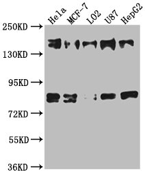 Western Blot Positive WB detected in: Hela whole cell lysate, MCF-7 whole cell lysate, L02 whole cell lysate, U87 whole cell lysate, HepG2 whole cell lysate All lanes: ZFYVE9 antibody at 1:1000 Secondary Goat polyclonal to rabbit IgG at 1/50000 dilution Predicted band size: 157, 151, 84 kDa Observed band size: 157 kDa Western Blot Positive WB detected in: Hela whole cell lysate, MCF-7 whole cell lysate, L02 whole cell lysate, U87 whole cell lysate, HepG2 whole cell lysate All lanes: ZFYVE9 antibody at 1:1000 Secondary Goat polyclonal to rabbit IgG at 1/50000 dilution Predicted band size: 157, 151, 84 kDa Observed band size: 157 kDa