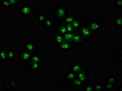 Immunofluorescence staining of Hela cells with CSB-PA026625LA01HU at 1:100, counter-stained with DAPI. The cells were fixed in 4% formaldehyde, permeabilized using 0.2% Triton X-100 and blocked in 10% normal Goat Serum. The cells were then incubated with the antibody overnight at 4°C. The secondary antibody was Alexa Fluor 488-congugated AffiniPure Goat Anti-Rabbit IgG(H+L).