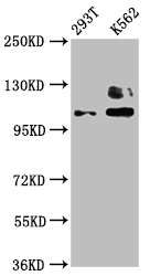 Western Blot Positive WB detected in: 293T whole cell lysate, K562 whole cell lysate All lanes: ZNF268 antibody at 4microg/ml Secondary Goat polyclonal to rabbit IgG at 1/50000 dilution Predicted band size: 109, 90, 10, 12, 16, 6, 13 kDa Observed band size: 109 kDa Western Blot Positive WB detected in: 293T whole cell lysate, K562 whole cell lysate All lanes: ZNF268 antibody at 4microg/ml Secondary Goat polyclonal to rabbit IgG at 1/50000 dilution Predicted band size: 109, 90, 10, 12, 16, 6, 13 kDa Observed band size: 109 kDa