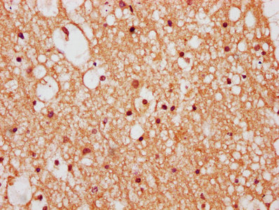 IHC image of CSB-PA026638LA01HU diluted at 1:400 and staining in paraffin-embedded human brain tissue performed on a Leica BondTM system. After dewaxing and hydration, antigen retrieval was mediated by high pressure in a citrate buffer (pH 6.0). Section was blocked with 10% normal goat serum 30min at RT. Then primary antibody (1% BSA) was incubated at 4°C overnight. The primary is detected by a biotinylated secondary antibody and visualized using an HRP conjugated SP system. IHC image of CSB-PA026638LA01HU diluted at 1:400 and staining in paraffin-embedded human brain tissue performed on a Leica BondTM system. After dewaxing and hydration, antigen retrieval was mediated by high pressure in a citrate buffer (pH 6.0). Section was blocked with 10% normal goat serum 30min at RT. Then primary antibody (1% BSA) was incubated at 4°C overnight. The primary is detected by a biotinylated secondary antibody and visualized using an HRP conjugated SP system.