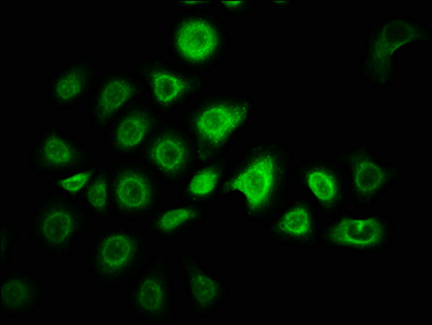 Immunofluorescence staining of A549 cells with CSB-PA026785LA01HU at 1:166, counter-stained with DAPI. The cells were fixed in 4% formaldehyde, permeabilized using 0.2% Triton X-100 and blocked in 10% normal Goat Serum. The cells were then incubated with the antibody overnight at 4°C. The secondary antibody was Alexa Fluor 488-congugated AffiniPure Goat Anti-Rabbit IgG(H+L). Immunofluorescence staining of A549 cells with CSB-PA026785LA01HU at 1:166, counter-stained with DAPI. The cells were fixed in 4% formaldehyde, permeabilized using 0.2% Triton X-100 and blocked in 10% normal Goat Serum. The cells were then incubated with the antibody overnight at 4°C. The secondary antibody was Alexa Fluor 488-congugated AffiniPure Goat Anti-Rabbit IgG(H+L).