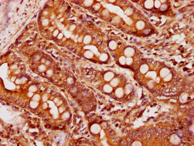 IHC image of CSB-PA05799A0Rb diluted at 1:600 and staining in paraffin-embedded human small intestine tissue performed on a Leica BondTM system. After dewaxing and hydration, antigen retrieval was mediated by high pressure in a citrate buffer (pH 6.0). Section was blocked with 10% normal goat serum 30min at RT. Then primary antibody (1% BSA) was incubated at 4°C overnight. The primary is detected by a biotinylated secondary antibody and visualized using an HRP conjugated SP system.